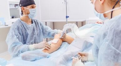 chirurgie voor spataderen